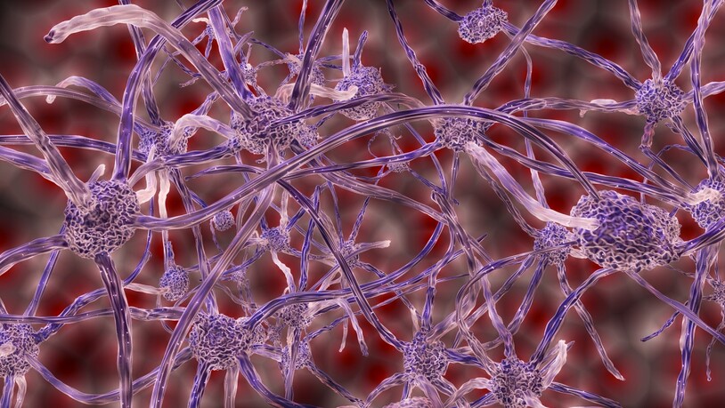 Eine abstrakte Abbildung eines Nervenzellen-Netzwerks: Multiple Sklerose, eine entzündliche Erkrankung der Nervenzellen, scheint durch eine Infektion mit dem Epstein-Barr-Virus ausgelöst zu werden.