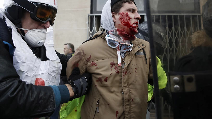 Ein Vertreter der "Gelbwesten" ist bei den Ausschreitungen auf der Place de la République in Paris verletzt worden.