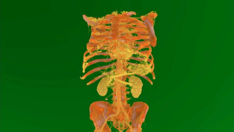Virtuelles Modell des Torsos eines Patienten.