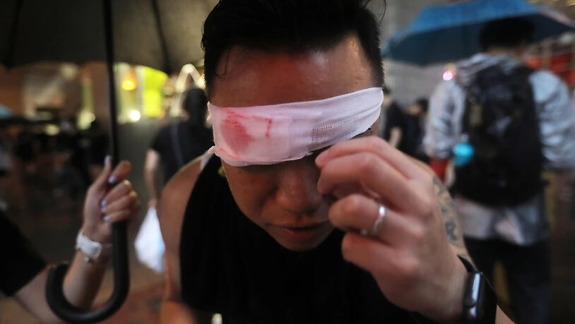 Ein Protestierender hat eine Augenbinde angezogen, um so seine Solidarität mit einer Frau zu zeigen, die bei den Protesten am Auge verletzt worden war.