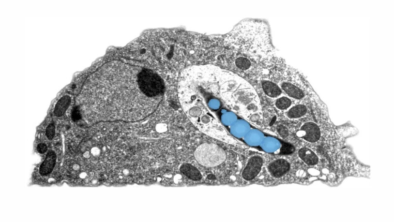 Elektronenmikroskopische Aufnahme einer Amöbe, die mit dem Tuberkulose-Erreger (blau) infiziert ist.