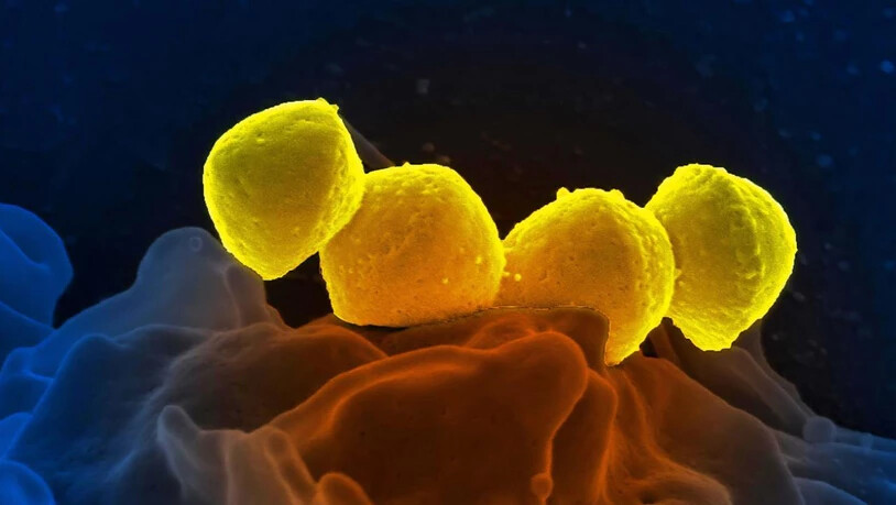 Ein neu entwickelter Verband tötet antibiotikaresistente Bakterien (gelb) in Wunden ab.
