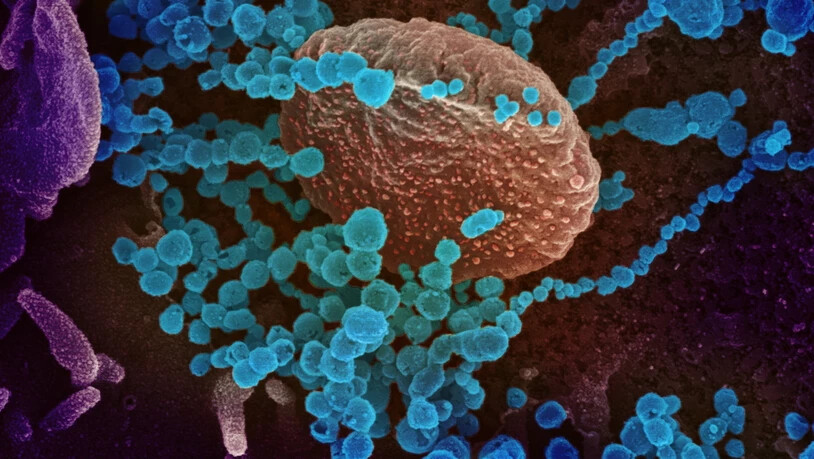 Eine Elektronenmikroskopische Aufnahme von SARS-CoV-2 (blaue Objekte): Forschende der Uni Bern haben im Labor untersucht, welche Wirkstoffe das Virus in Zellen hemmen. (Symbolbild)