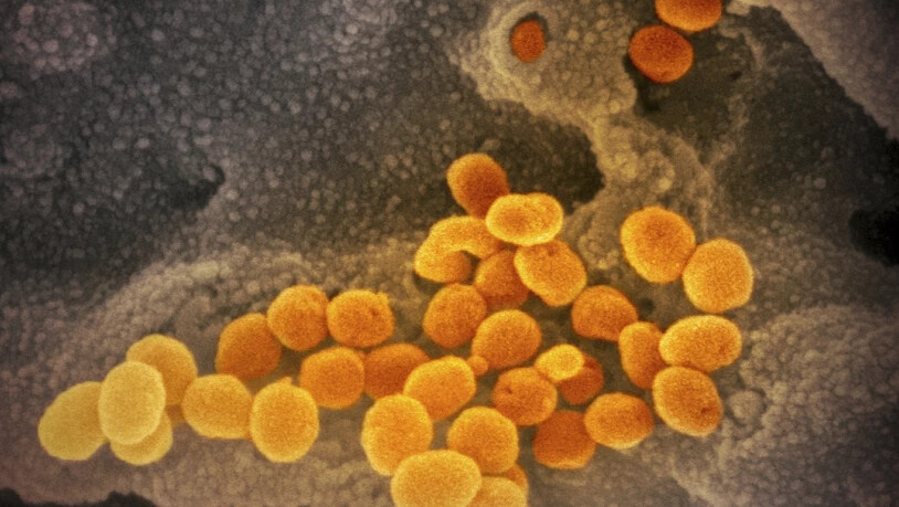 ARCHIV - Eine elektronenmikroskopische Aufnahme des «U.S. National Institute of Health» zeigt das neuartige Coronavirus (SARS-CoV-2), das aus der Oberfläche von im Labor kultivierten Zellen austritt. Foto: NIAID-RML/AP/dpa - ACHTUNG: Nur zur…