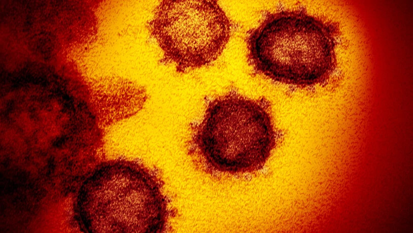 ARCHIV - Eine Elektronenmikroskopaufnahme zeigt das Coronavirus SARS-CoV-2, das von einem Patienten isoliert wurde und aus der Oberfläche von im Labor kultivierten Zellen austritt. Foto: Niaid-Rml/ZUMA Wire/dpa