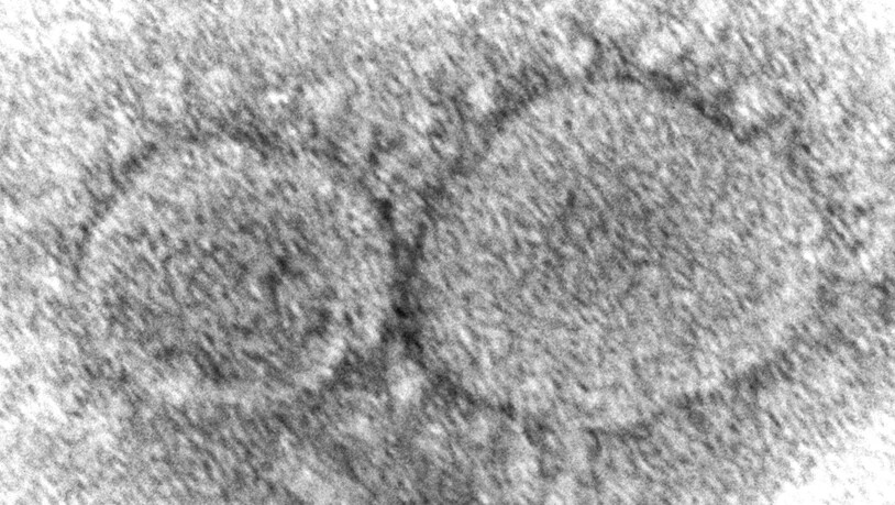 Ein Elektronenmikroskop-Bild von Sars-CoV-2: Eine neue Studie zeigt, dass sich das neue Coronavirus besonders effizient bei Temperaturen vermehrt, wie sie in den oberen Atemwegen herrschen. (Archivbild)