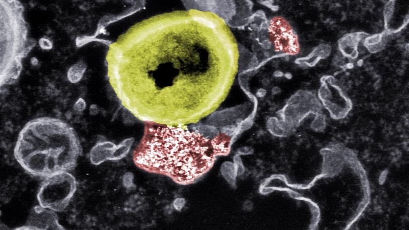 Forschende haben Nanopartikel (rot) entwickelt, die resistente Bakterien (gelb) in Zellkultur abtöten können. (Pressebild)