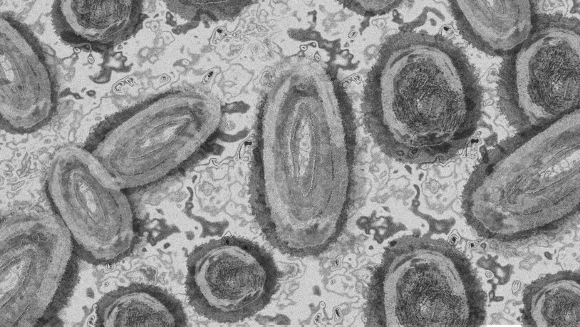 Affenpocken: Das Virus sitzt in Nagetieren, die von Menschen und Affen in Afrika verzehrt oder als Haustiere berührt werden.