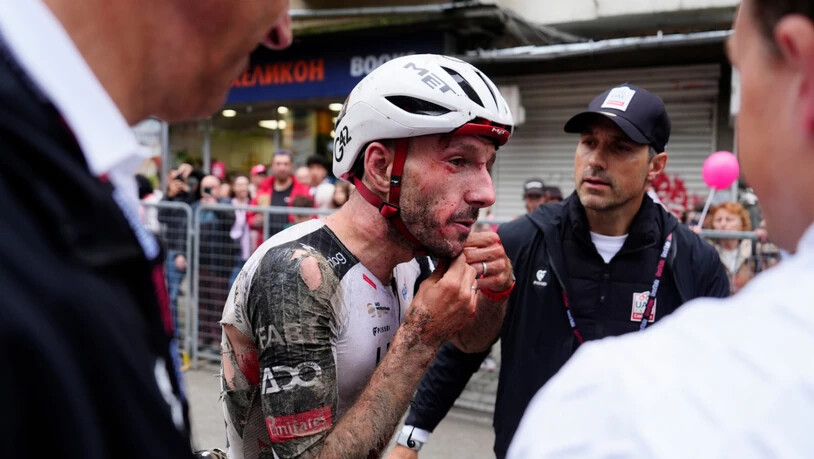 Gezeichnet vom schweren Sturz: Adam Yates im Ziel der 2. Etappe