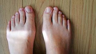 Der Zeh des Anstosses: Das Gericht muss entscheiden, ob die Verletzung am Zeh eines Nachtwächters wegen falscher Schuhe oder eines Missgeschicks ist.