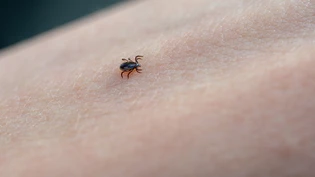 Klein, aber gefährlich: Zecken können schwerwiegende Krankheiten übertragen.